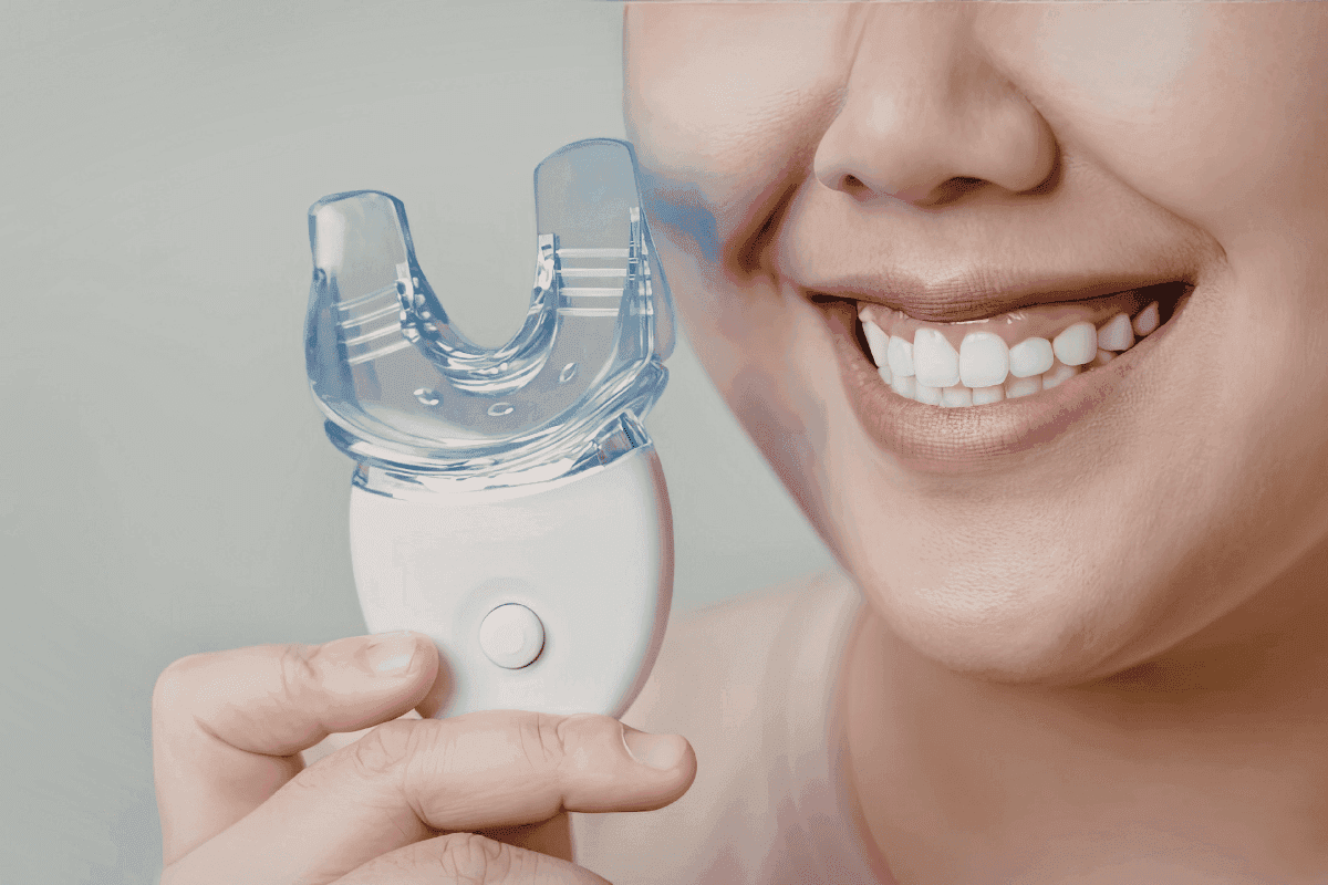 SAP Dental Laboratory — Bleaching Trays